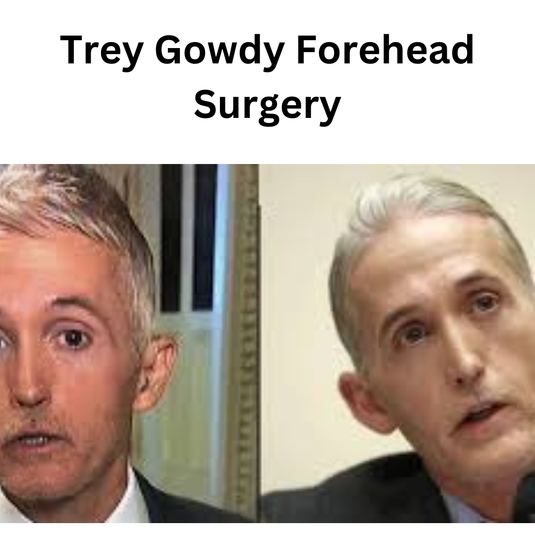 Trey Gowdy Forehead Surgery