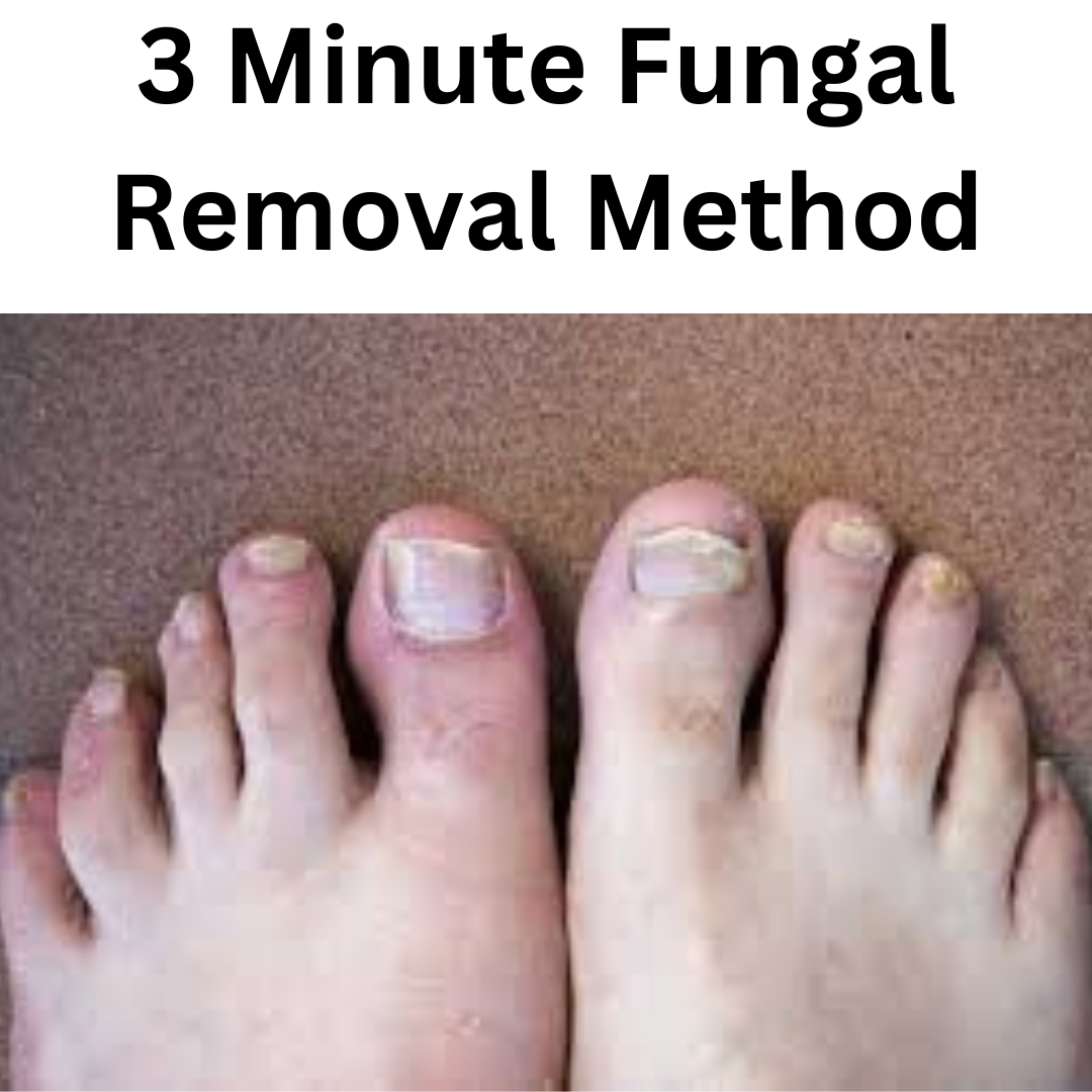 3 minute fungal removal method