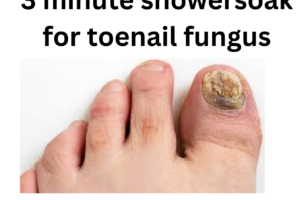 This 3-Minute Shower Soak For Tonail Fungus