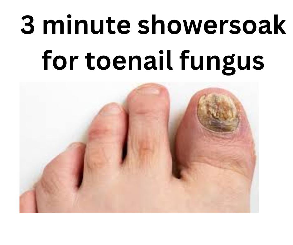 This 3-Minute Shower Soak For Tonail Fungus