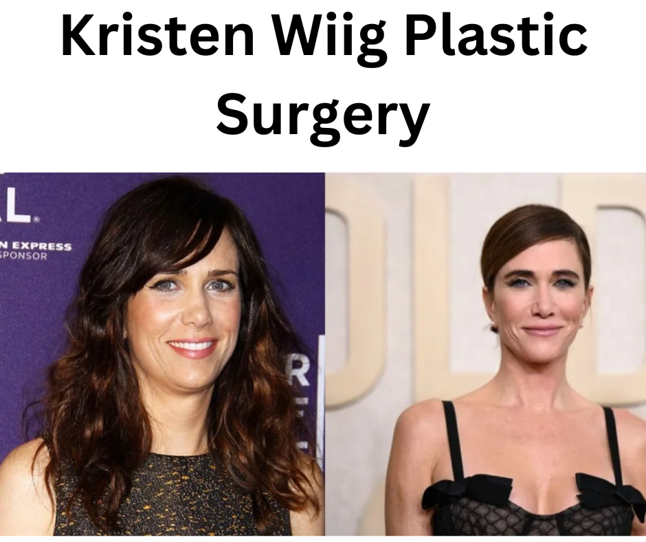 Kristen Wiig Plastic Surgery