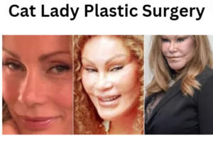 Cat Lady Plastic Surgery