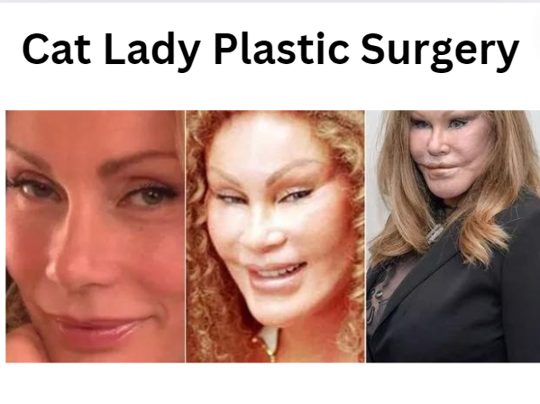 Cat Lady Plastic Surgery